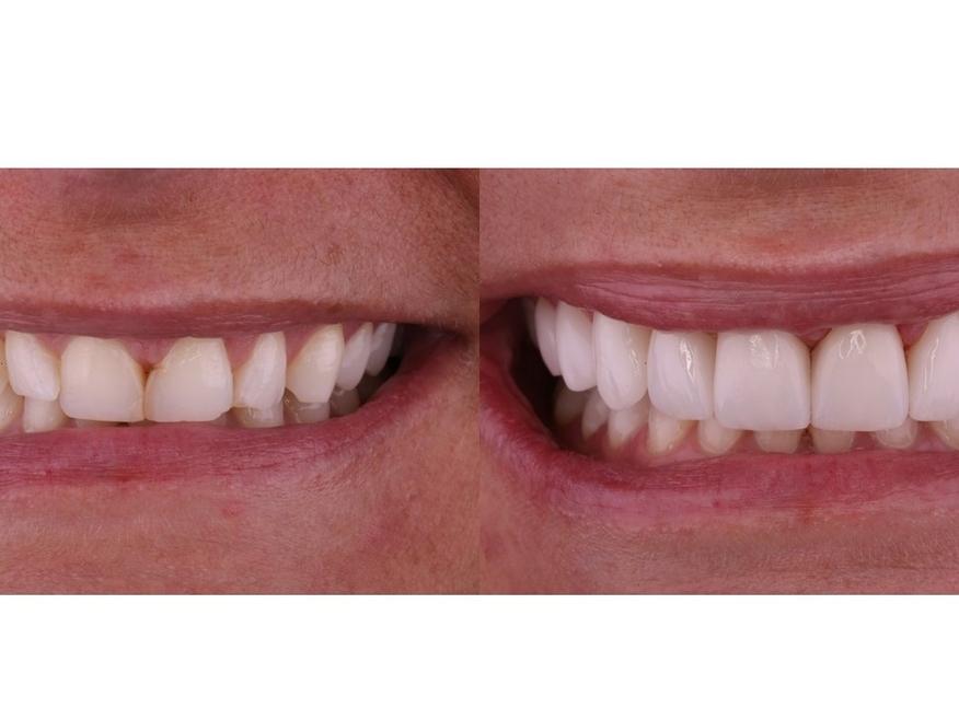 Patient from Great Divide Dental