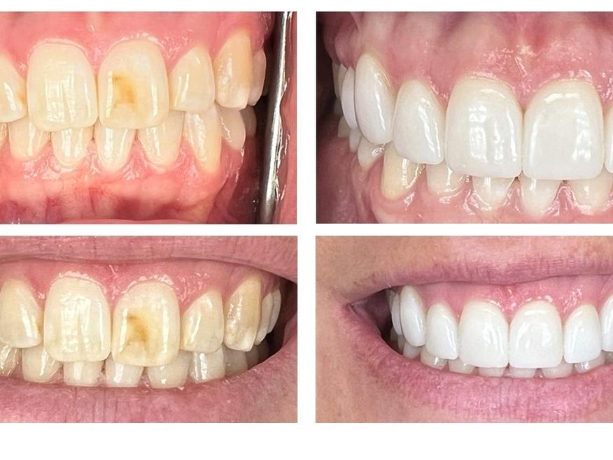 Patient from Great Divide Dental