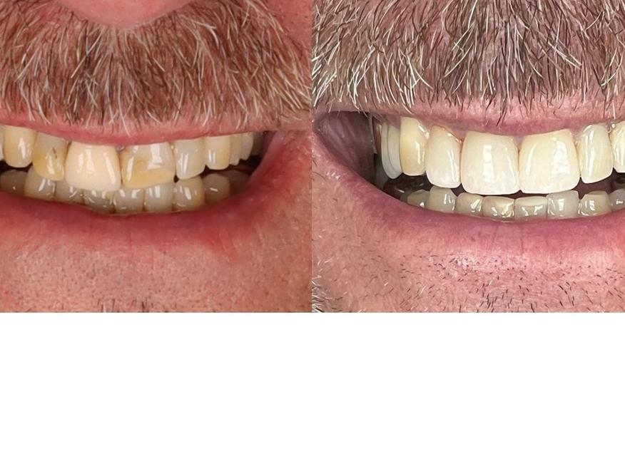 Patient from Great Divide Dental