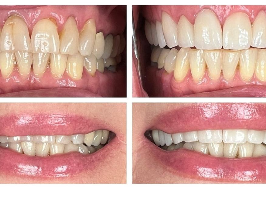 Patient from Great Divide Dental