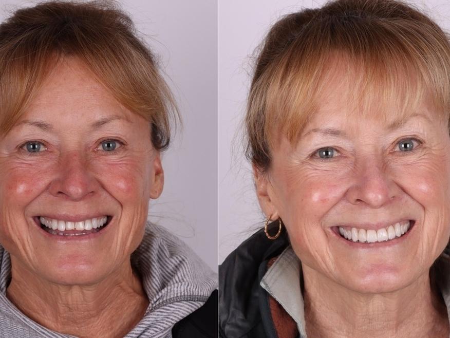 Patient from Great Divide Dental