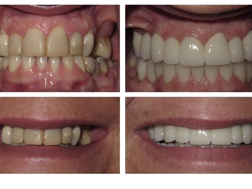 Patient from Great Divide Dental