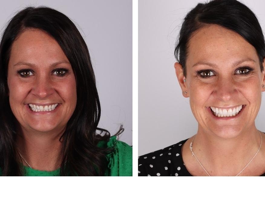 Patient from Great Divide Dental