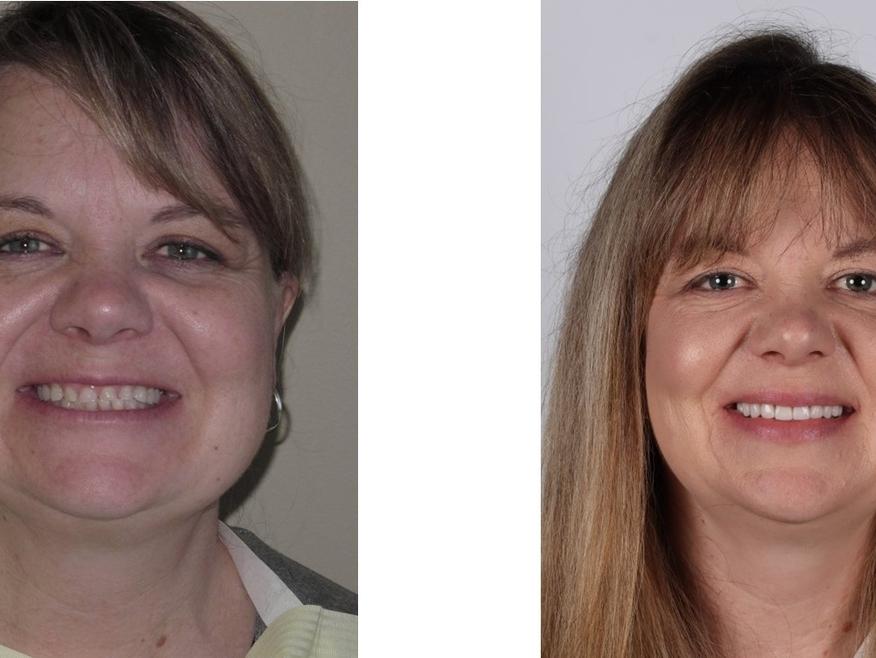 Patient from Great Divide Dental