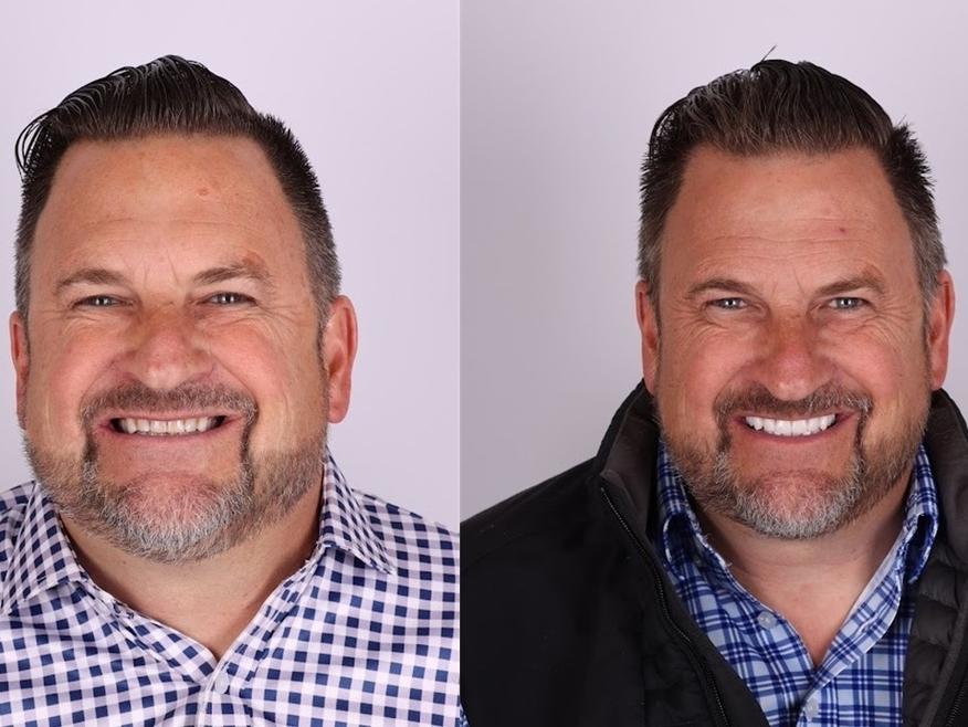 Patient from Great Divide Dental