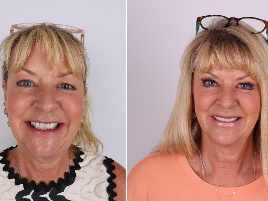 Patient from Great Divide Dental